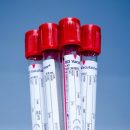 Скворцова назвала группу крови большинства заразившихся коронавирусом