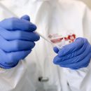 В Москве анонсировали проведение бесплатных тестов на антитела к коронавирусу