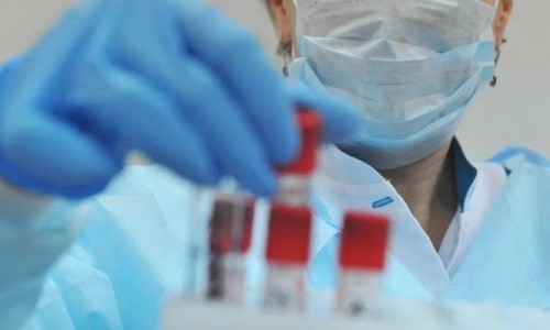 В Москве скончались двое граждан с коронавирусной инфекцией В Москве скончались двое граждан с коронавирусной инфекцией