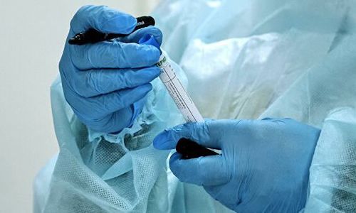 В Татарстане выявлено девять новых случаев коронавируса, почти все — контактные В Татарстане выявлено девять новых случаев коронавируса, почти все — контактные