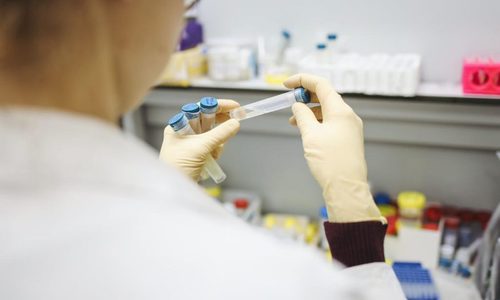 У первых добровольцев, испытавших вакцину от коронавируса, выявлены антитела