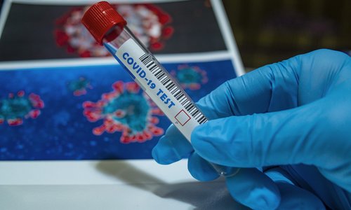 Найдена мутация коронавируса, к которой бессильны антитела Найдена мутация коронавируса, к которой бессильны антитела